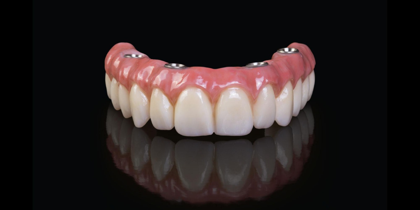 Fully fixed denture