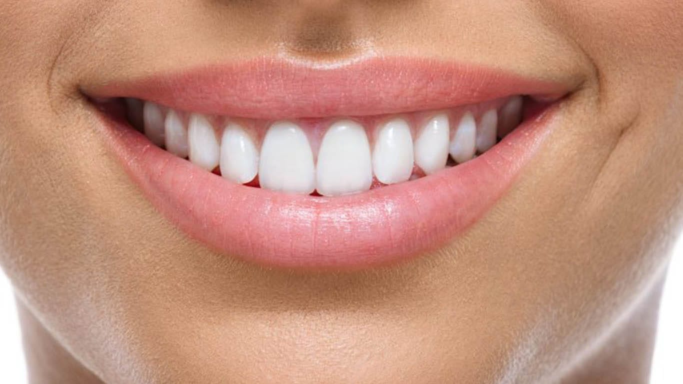 Smile design (smile make over)