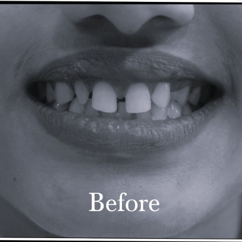 Before-Slider1