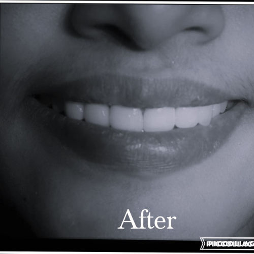 After-Slider1