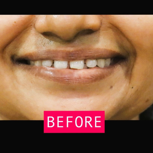 Before-Dental-1