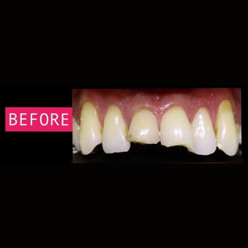 Before-Dental-2