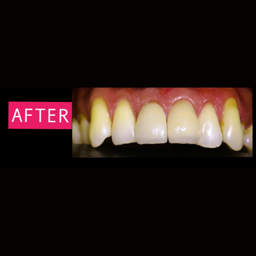 After-Dental-2